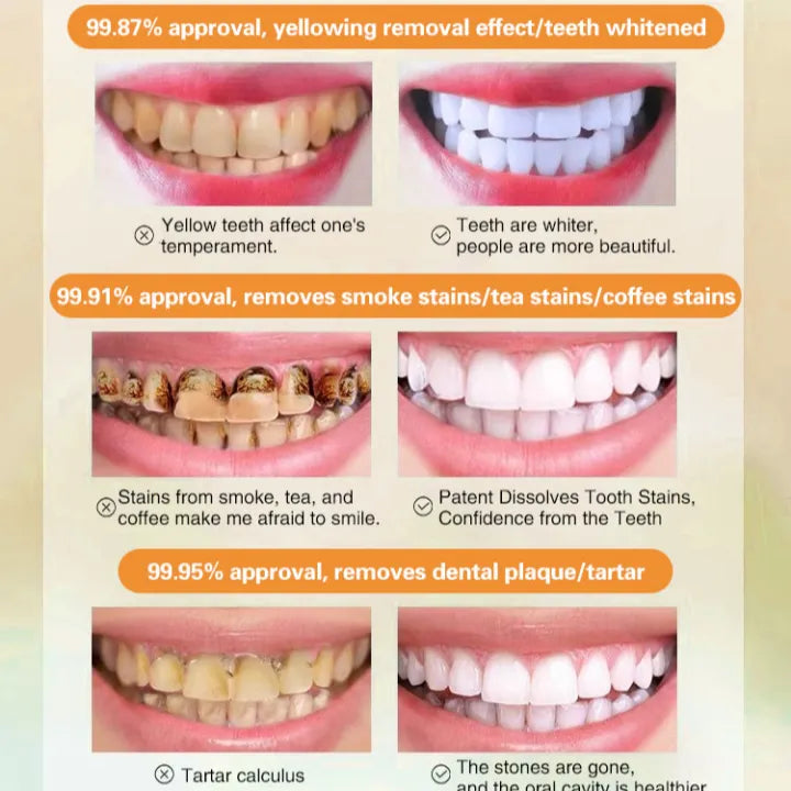 🔥 buy 1 get 1 free! 🔥long lasting perfume toothpaste fresh breath toothpaste gum care and whitening toothpaste