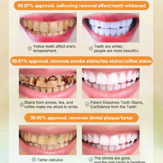 🔥 BUY 1 GET 1 FREE! 🔥Long Lasting Perfume Toothpaste Fresh Breath Toothpaste Gum Care And Whitening Toothpaste