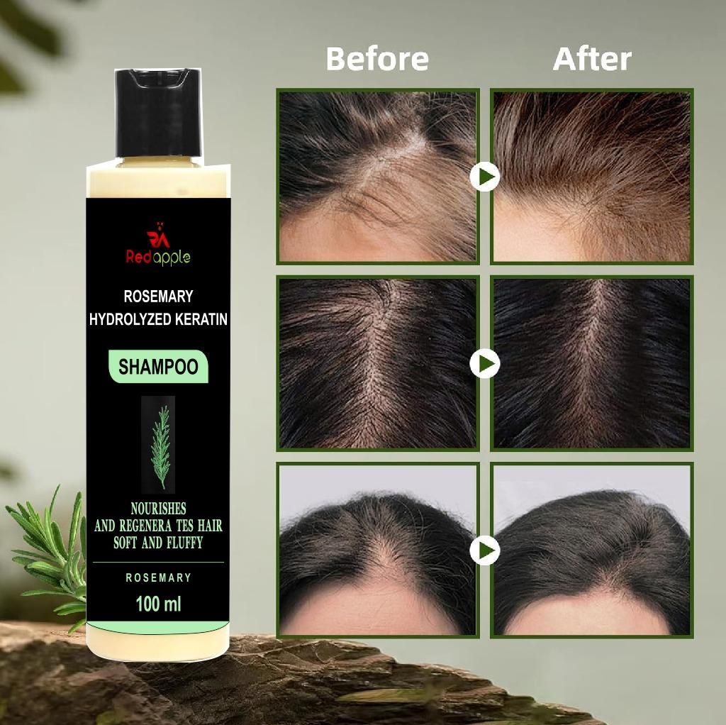 rosemary hydrolyzed keratin shampoo 200 ml pack of 2