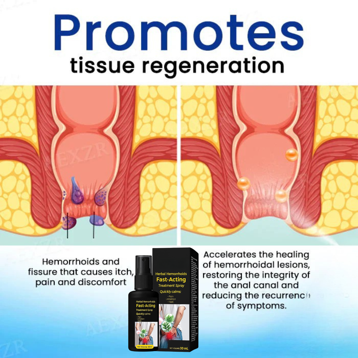 🔥hot sale 50% off🔥🌿herbal hemorrhoids fast-acting treatment spray - 7 days to a happy , pain-free 🔥 buy 1 get 1 free! 🔥