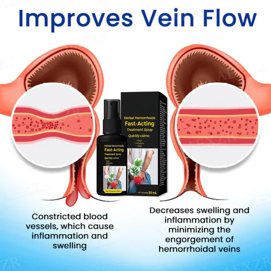 🔥Hot Sale 50% Off🔥🌿Herbal Hemorrhoids Fast-Acting Treatment Spray - 7 Days to a Happy , pain-Free 🔥 BUY 1 GET 1 FREE! 🔥