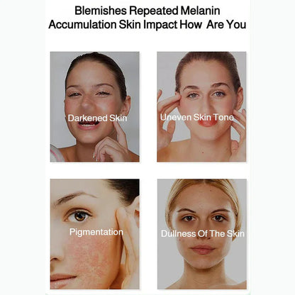 🎉Hot Sale🎉Radiant Skin & Spot Correcting Spray|Buy 1 Get 1 Free 💗